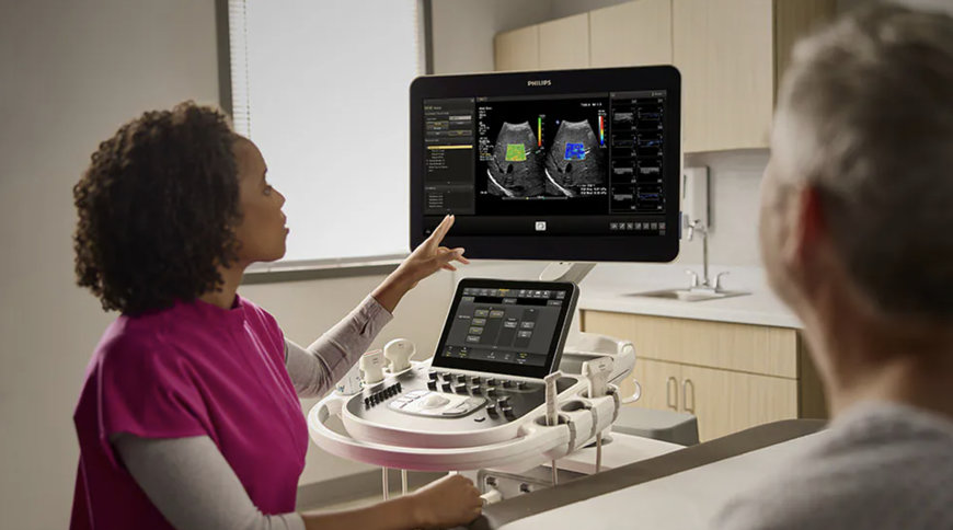 Philips&rsquo; new AI-assisted workflow speeds up exams and increases clinical confidence