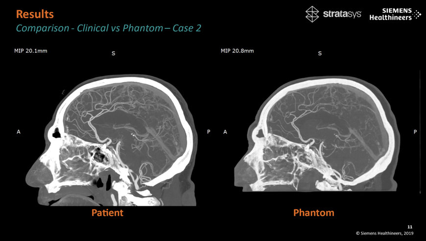 Stratasys and Siemens Healthineers Bring a New Era for Medical Imaging Research