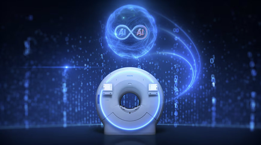 Philips accelerates precise imaging with unique AI technologies in MRI