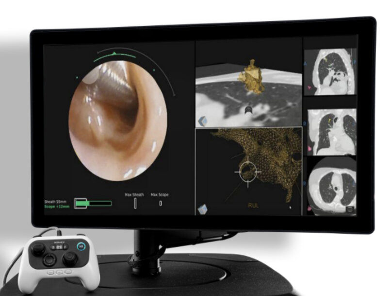 Johnson & Johnson MedTech Announces Clearance of MONARCH QUEST