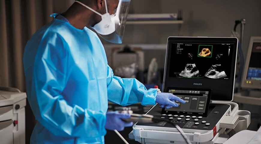 Philips enhances 5500CV ultrasound with AI for cardiac imaging
