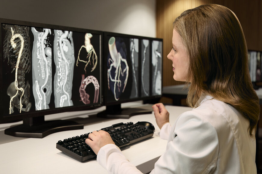 GE HealthCare launches Revolution Vibe CT with AI cardiac imaging
