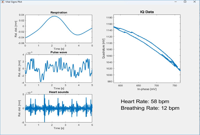 Fraunhofer Develops Radar-Based ECG for Contactless Heart Monitoring