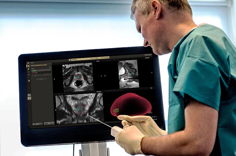 Prostate Cancer: Integrating Care Through Collaboration