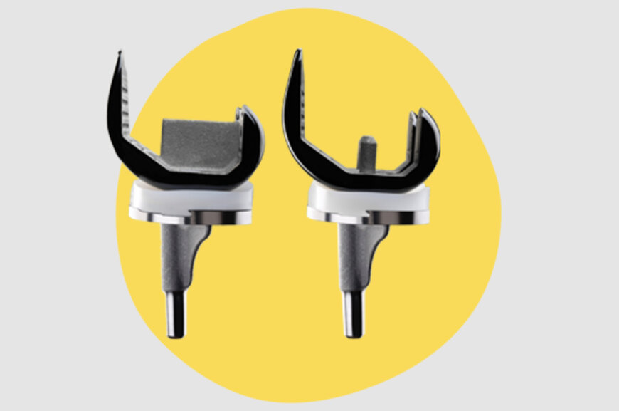 Smith+Nephew presents new medial stabilized insert for LEGION TKS
