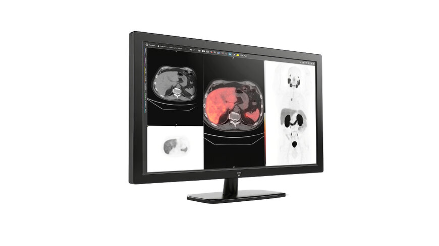 GE HealthCare's MIM Encore advances digital imaging and workflow solutions for precision care