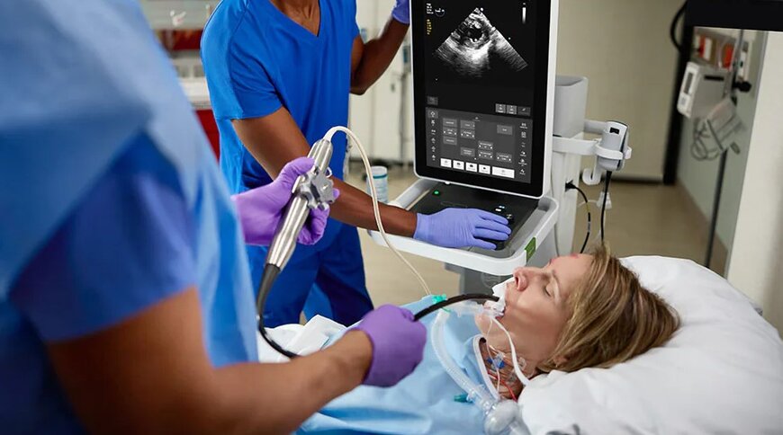 Philips Launches Flash 5100 PoC Ultrasound System