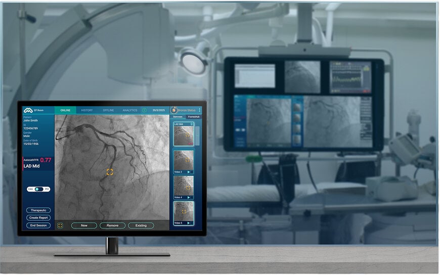 Terumo and MedHub-AI partner to market AI-based FFR in Japan