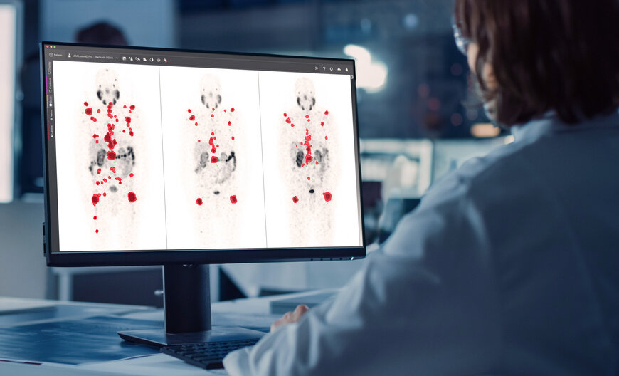 GE HealthCare Unveils AI Theranostics Tools to Advance Precision Oncology
