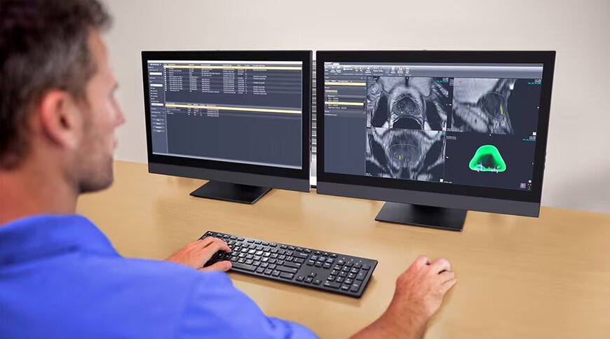 Philips UroNav Advances Prostate Cancer Care