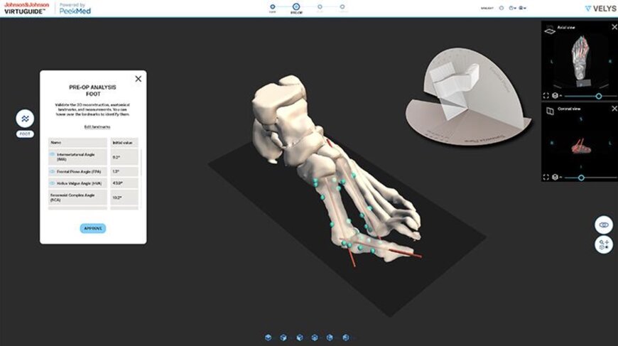 Johnson & Johnson Launches VIRTUGUIDE System in the U.S