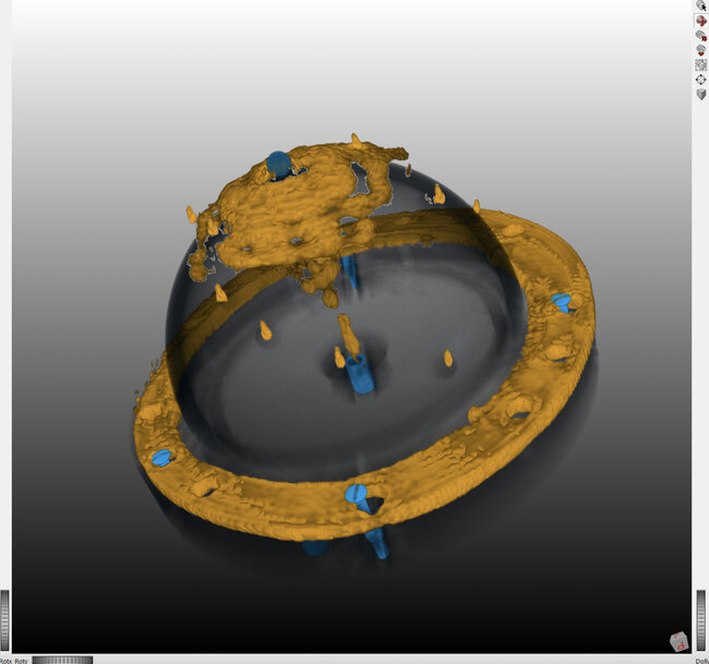 New Low-Radiation 3D Imaging Method Enhances Breast & Lung Cancer Diagnosis