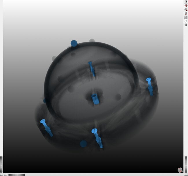 New Low-Radiation 3D Imaging Method Enhances Breast & Lung Cancer Diagnosis