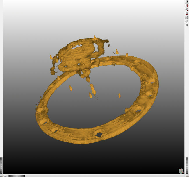 New Low-Radiation 3D Imaging Method Enhances Breast & Lung Cancer Diagnosis