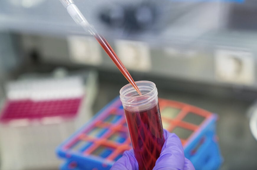 Fraunhofer Develops Non-Invasive Pancreatic Cancer Detection Using NGS Technology