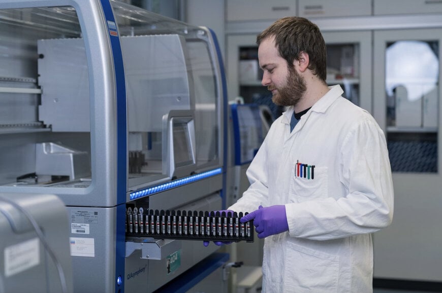 Fraunhofer Develops Non-Invasive Pancreatic Cancer Detection Using NGS Technology