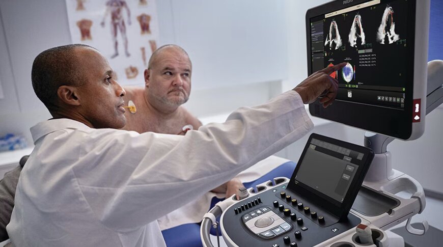 Philips launches Transcend Plus with FDA-cleared AI enhancements in cardiovascular imaging