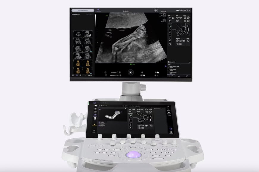 GE HealthCare launches AI-powered Voluson Performance 18 & 16 ultrasound