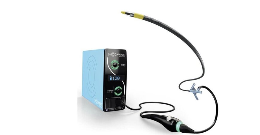 Shockwave Javelin IVL Catheter Targets Hard-to-Cross Artery Lesions