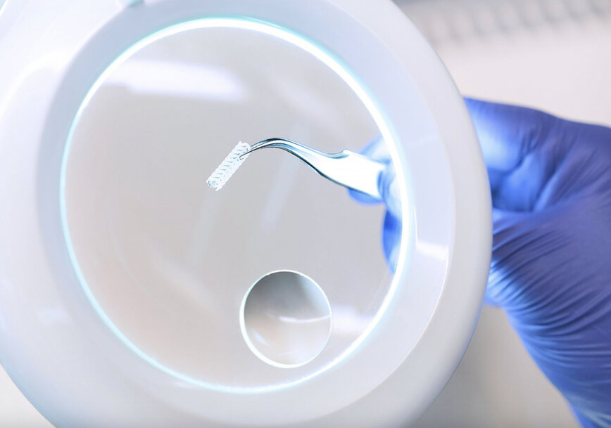 Fraunhofer IAP Develops Biodegradable Stent to Reduce Thrombosis Risk