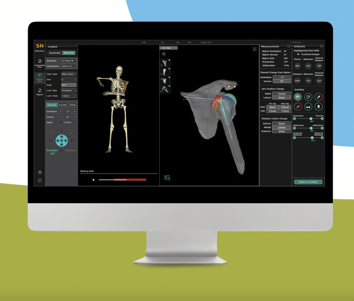 Smith+Nephew expands CORIOGRAPH Services with shoulder pre-op planning launch