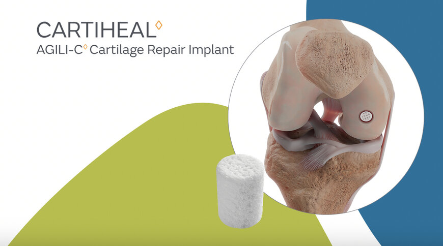 Smith+Nephew earns new AMA CPT code for CARTIHEAL implant 