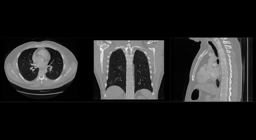 Philips Advances Synthetic Medical Imaging 