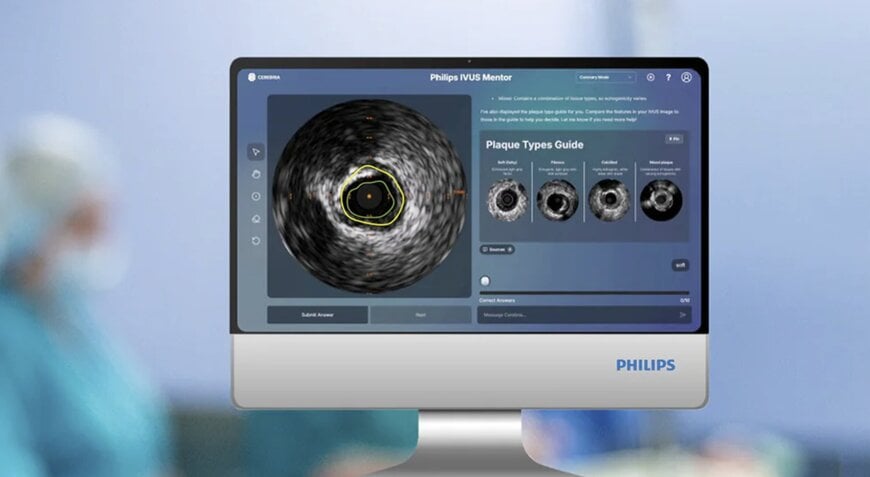 Philips Launches AI-Powered IVUS Mentor to Transform Clinician Training