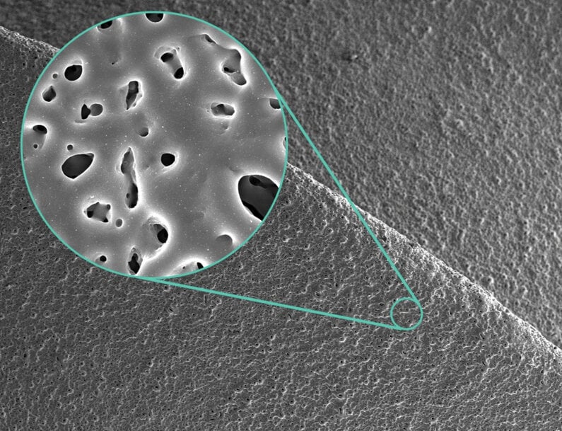 Fraunhofer IFAM Develops Antibiotic-Loading Surfaces to Prevent Implant Infections