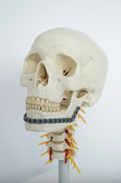 Fraunhofer IFAM Develops Antibiotic-Loading Surfaces to Prevent Implant Infections