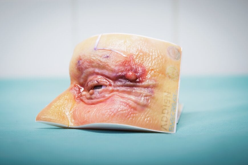 Stratasys Digital Anatomy Technology Powers First 3D-Printed Eyelid Surgery Training Models in Europe