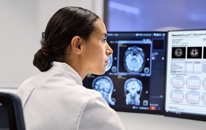 Philips and Cortechs.ai Advance AI Integration for Precision Neuroimaging Workflows