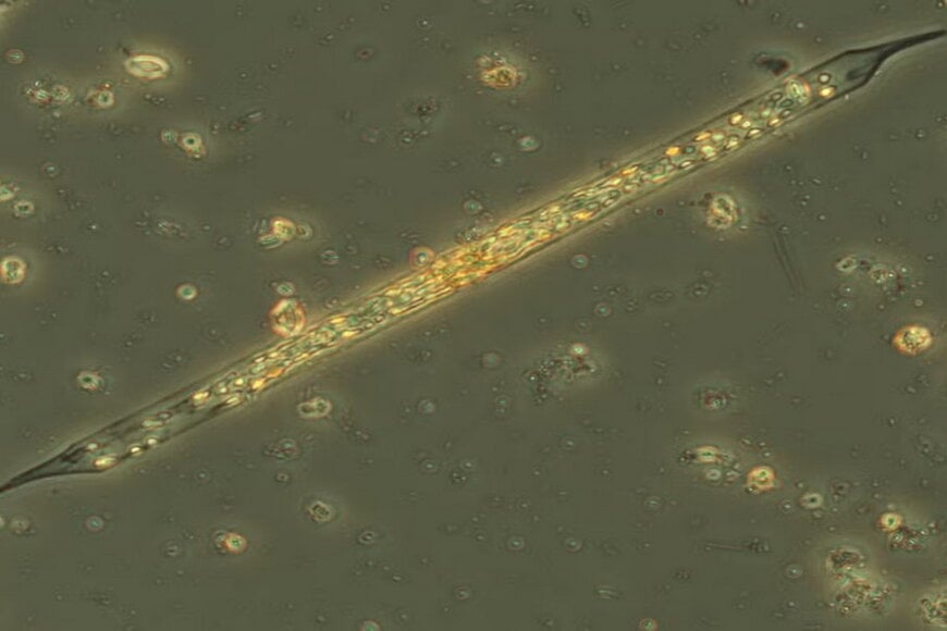 LG Sonic Tests Maryland Algae Control Technology