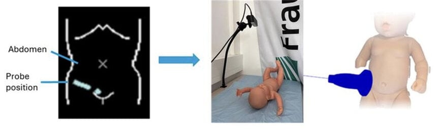 3D Camera Enables Automated Ultrasound Position Documentation