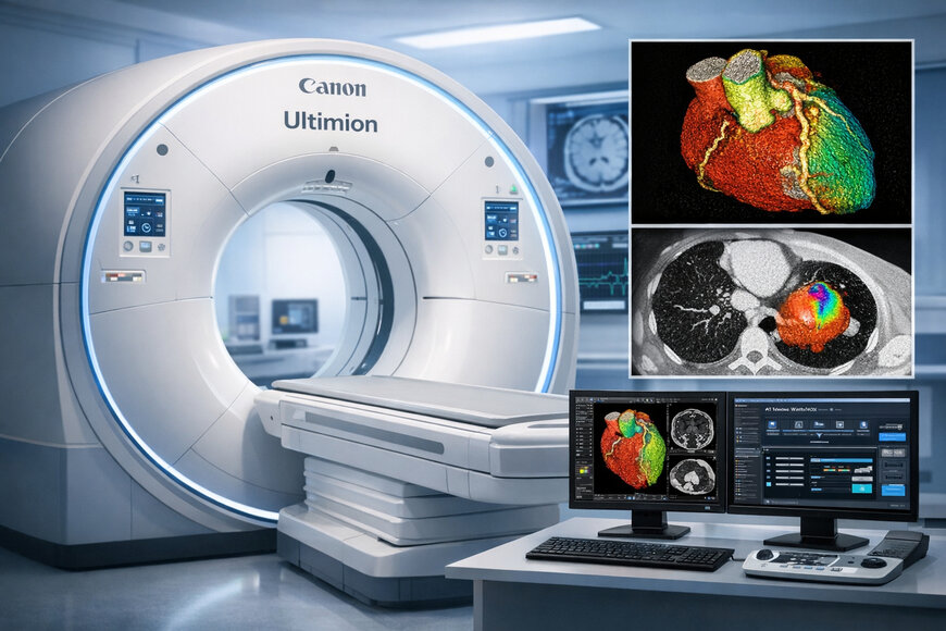 Photon-counting CT advances diagnostic imaging precision