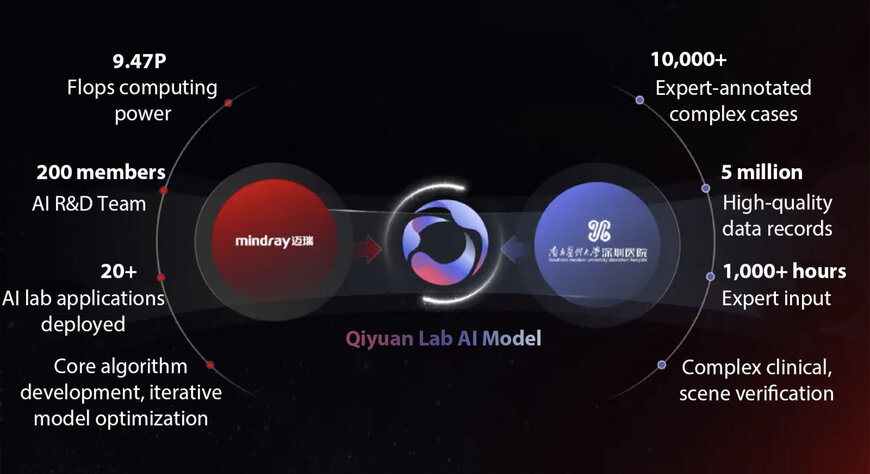 Mindray launches AI model for laboratory diagnostic decision support