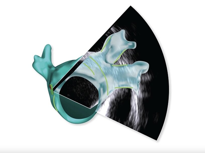 AI-enabled cardiac mapping and electrophysiology innovations