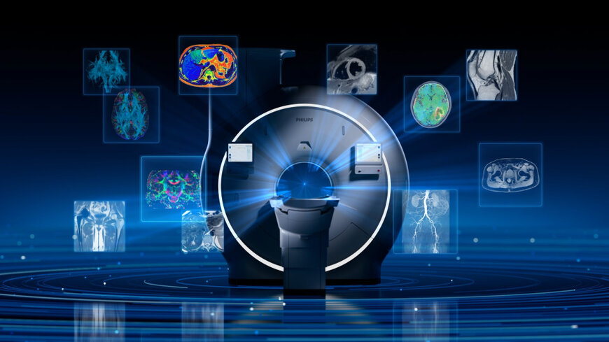 Ultra-high-gradient 3.0T MRI system for quantitative imaging