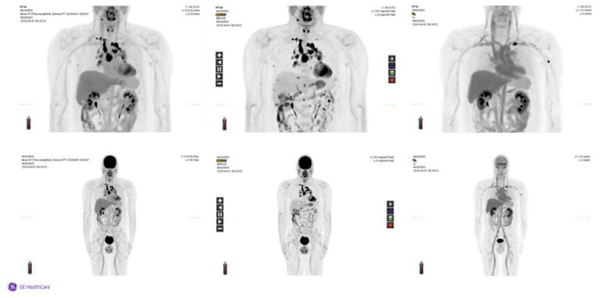 Quantitative Dynamic Imaging for Spatiotemporal Radiotracer Distribution Analysis