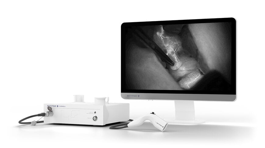 Fluorescence Imaging Technology for Small-Incision Endocrine and Lymphatic Procedures