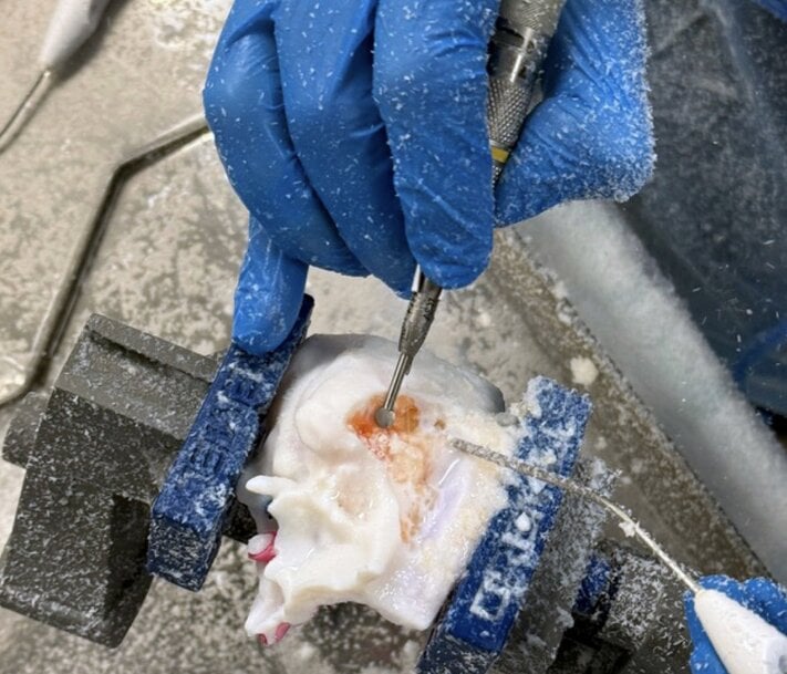 Advancing Surgical Training with 3D Printed Anatomical Models