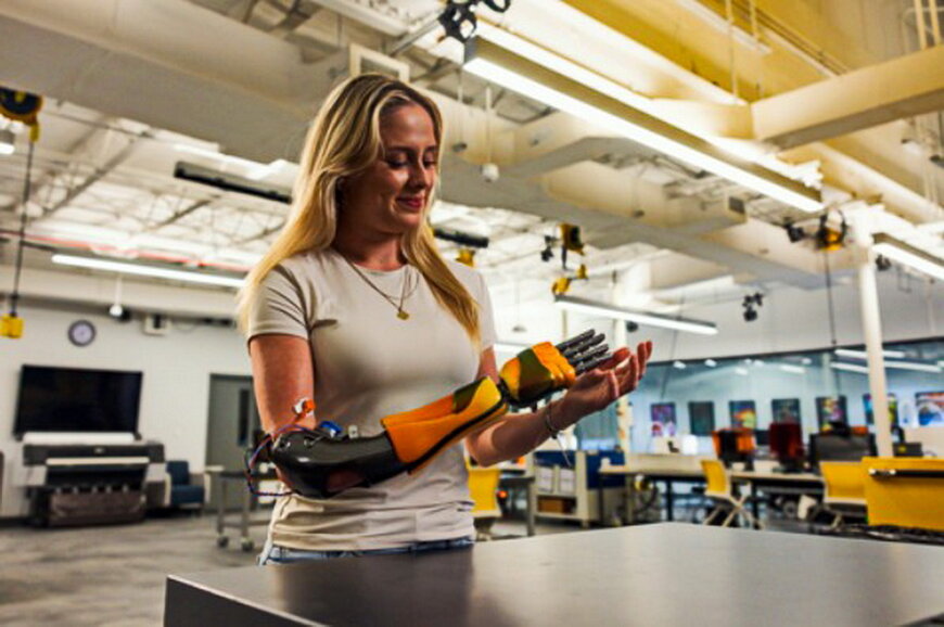 Additive Manufacturing in Pediatric Prosthetics Production