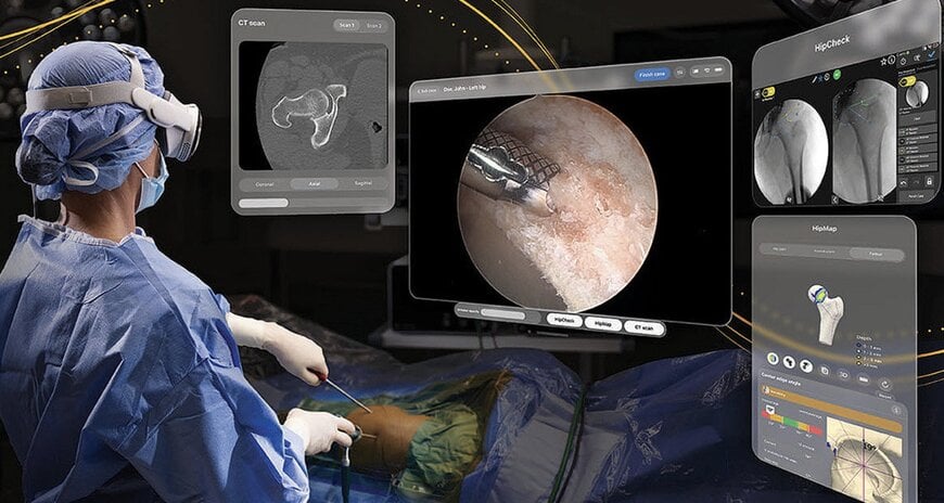 Stryker introduces first-of-its-kind FDA-authorized surgical application for Apple Vision Pro