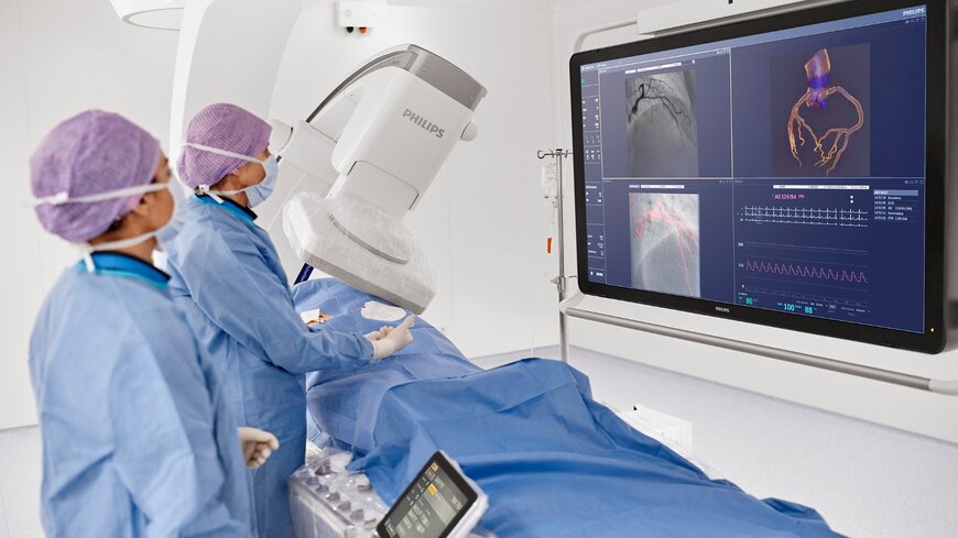 AI-Enabled Computed Tomography Workflow for Coronary Artery Disease
