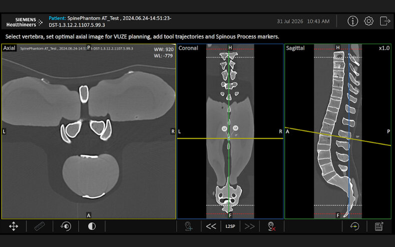 Trackerless Surgical Guidance Software for Spinal Screw Placement