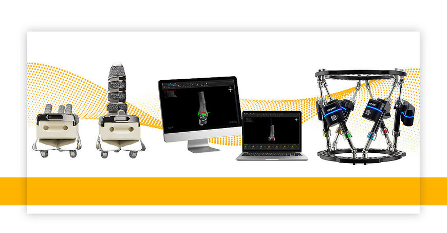 Total Ankle Arthroplasty and Hexapod Limb Deformity Planning Systems