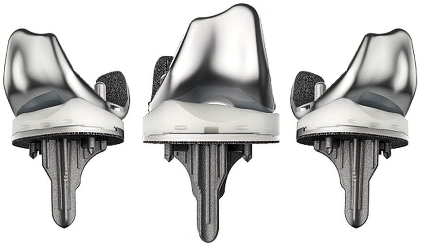 Robotic Arthroplasty Integration in Knee Replacement Systems