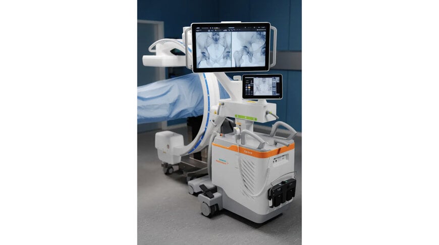 Mobile C-Arm Fluoroscopy System Architecture for Intraoperative Surgical Guidance